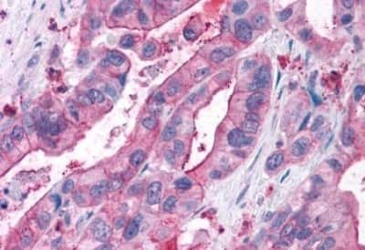 Immunohistochemistry: NPY5R Antibody [NBP3-14426]